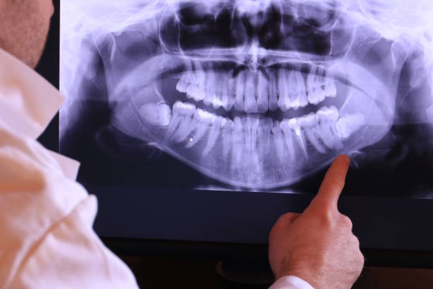 Best Emergency Pediatric Dental Care in North Laurel, MD